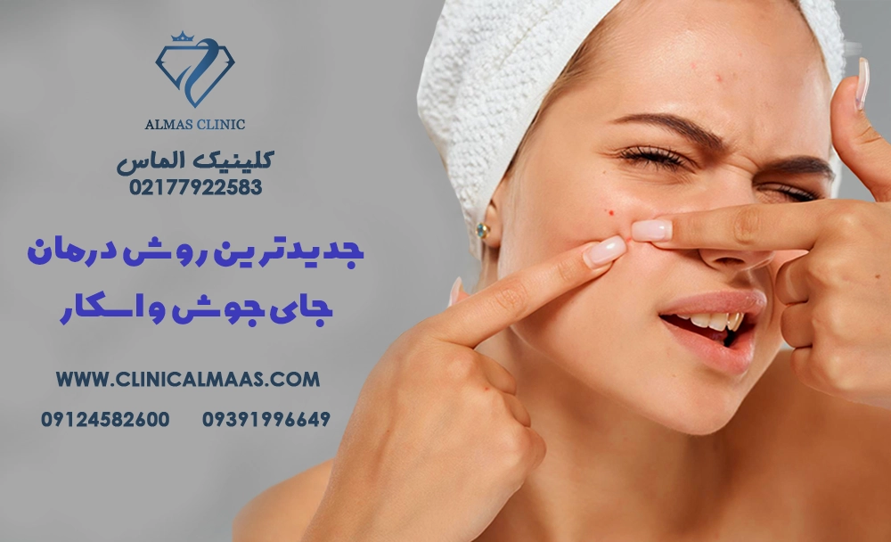 جدیدترین روش‌های درمان جای جوش و اسکار