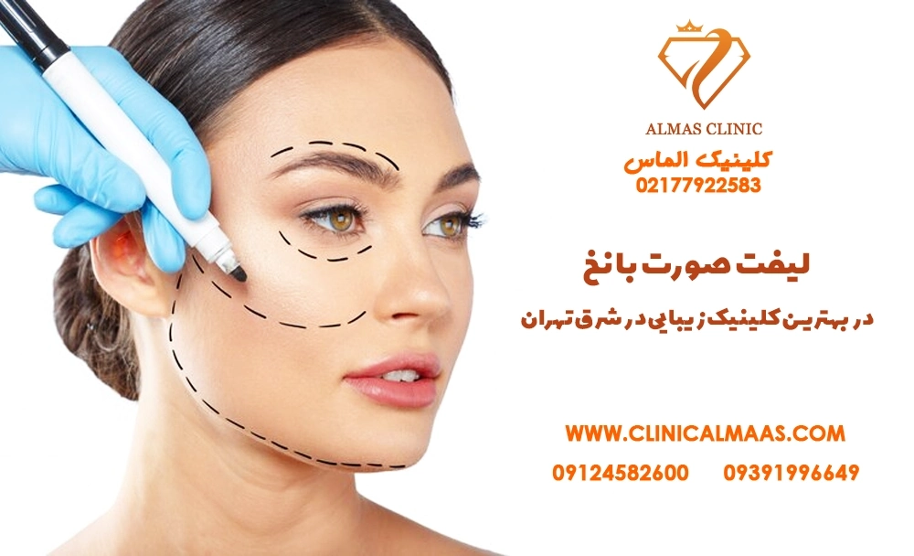 لیفت صورت با نخ در بهترین کلینیک زیبایی شرق تهران
