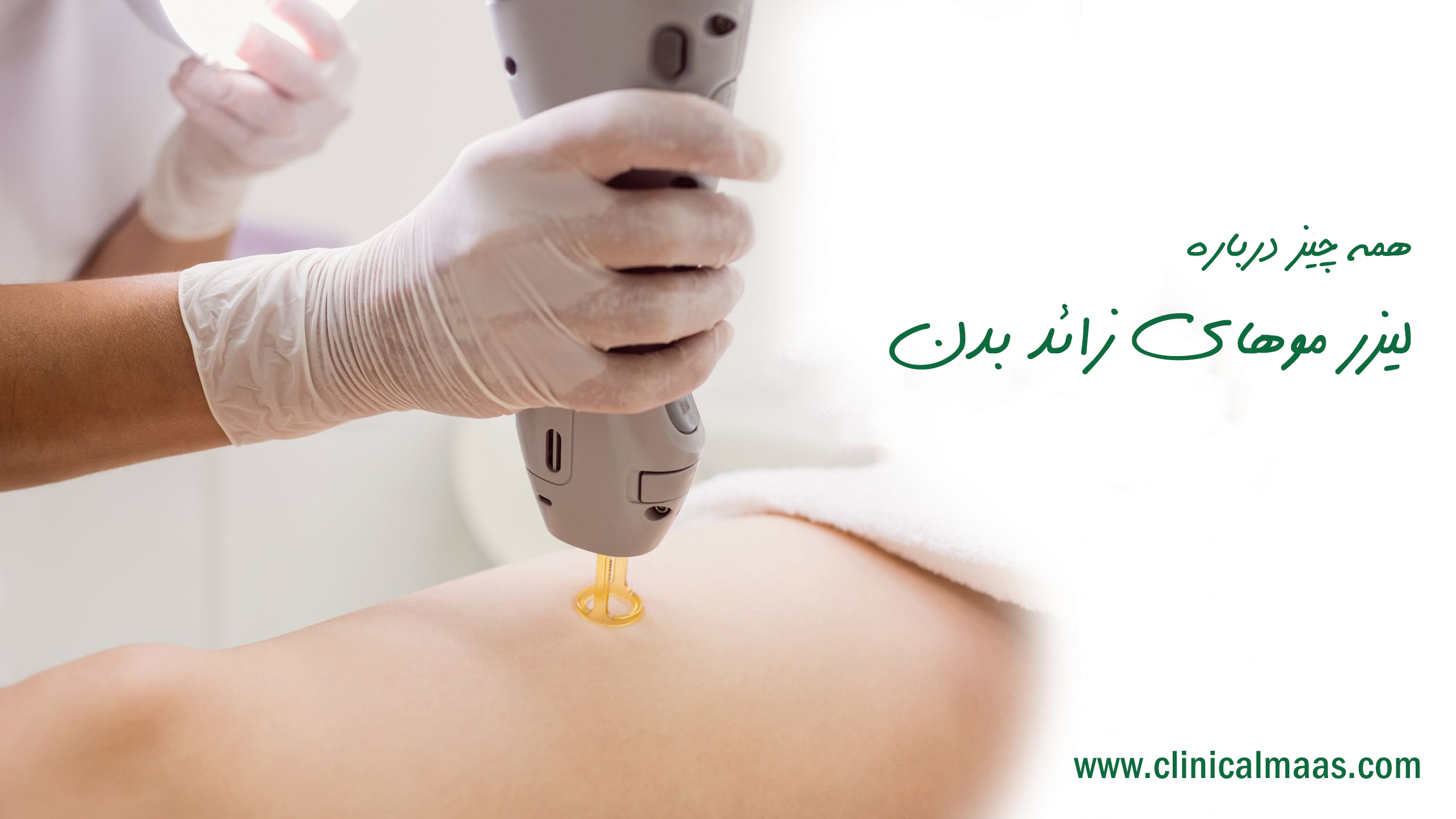 همه چیز درباره لیزر موهای زائد بدن
